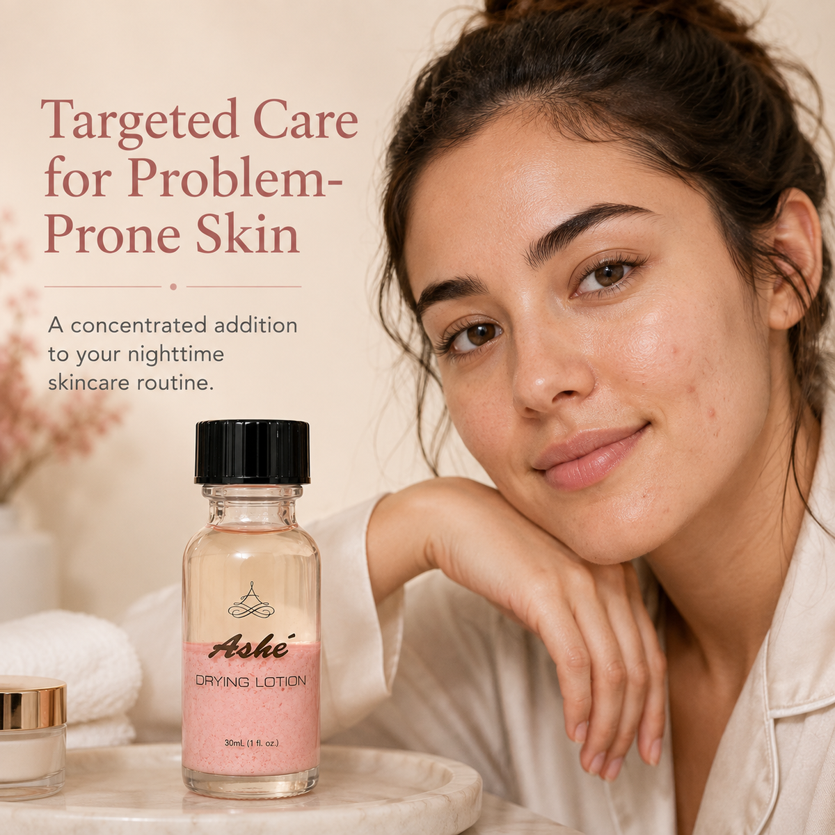 Ashé Acne Control Drying Lotion