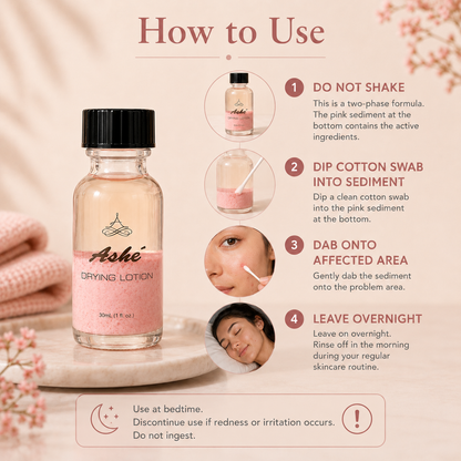 Ashé Acne Control Drying Lotion