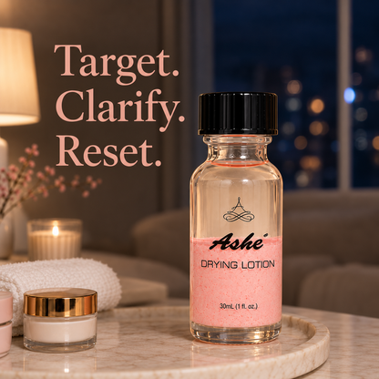 Ashé Acne Control Drying Lotion